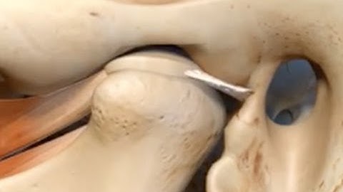 Disc Displacement