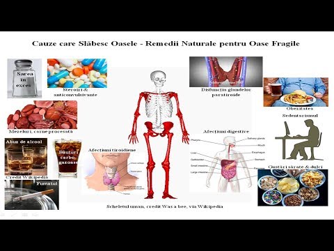 Clasificarea bolilor oaselor și articulațiilor - scaune-ieftine.ro