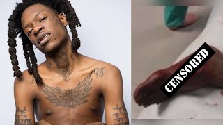 Jacksonville Rapper Foolio Shot In His Hometown Might Have To Amputate his Foot