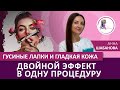 Гусиные лапки и гладкая кожа.  Двойной эффект в одну процедуру