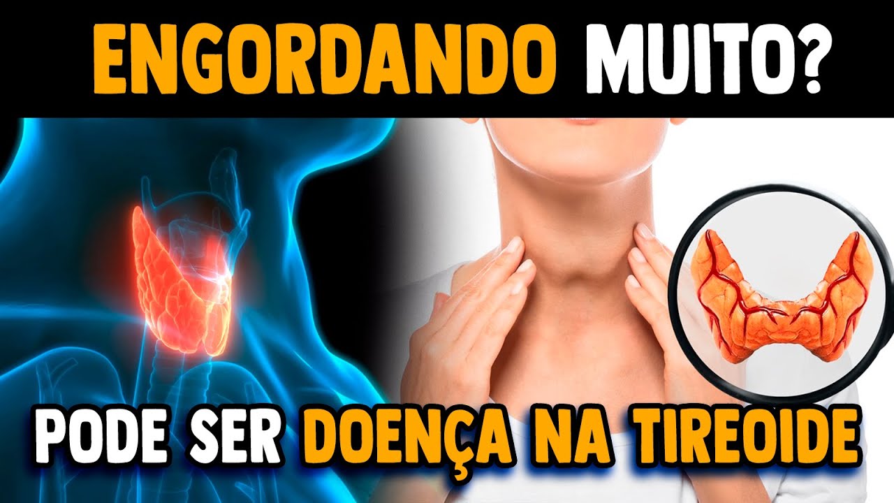 A tireoide pode estar te engordando! │ Sintomas e Causas de