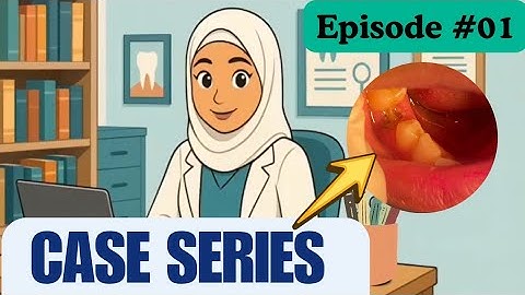 Case Series Episode #01 // Case of DRY SOCKET 