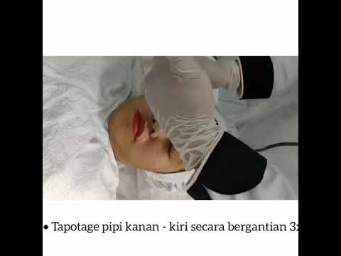 Video: Cryomassage Wajah - Deskripsi, Tindakan, Ulasan