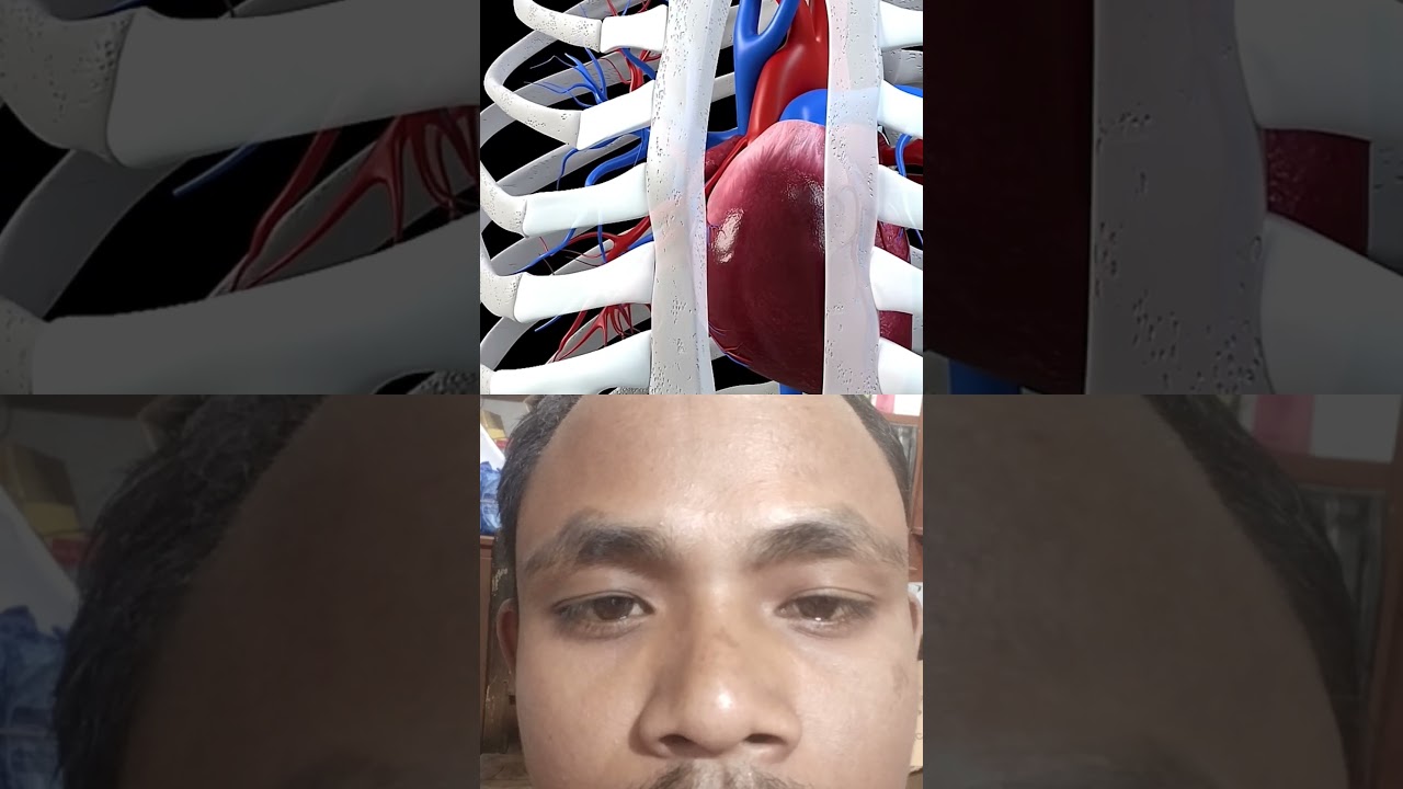 open heart🔪cardiac surgery 🫒hot bypass!!3d medical anatomy