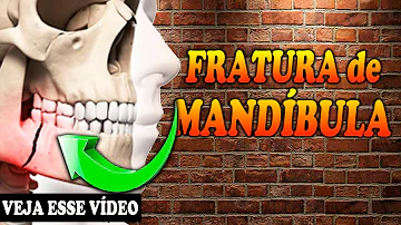 O que fazer quando se quebra o maxilar?