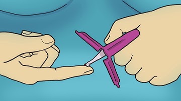 Collecting Microsamples: Remote Specimen Collection