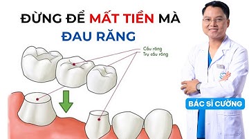 Cầu răng sứ: Đừng để hối hận mất tiền mà răng đau | Dr Cường Official