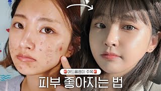 여드름 없애고 피부 좋아지는 법☀️ 피부시술 | 클렌징 | 스킨케어 | 습관 전부 알려드림️ 👩🏻‍🏫