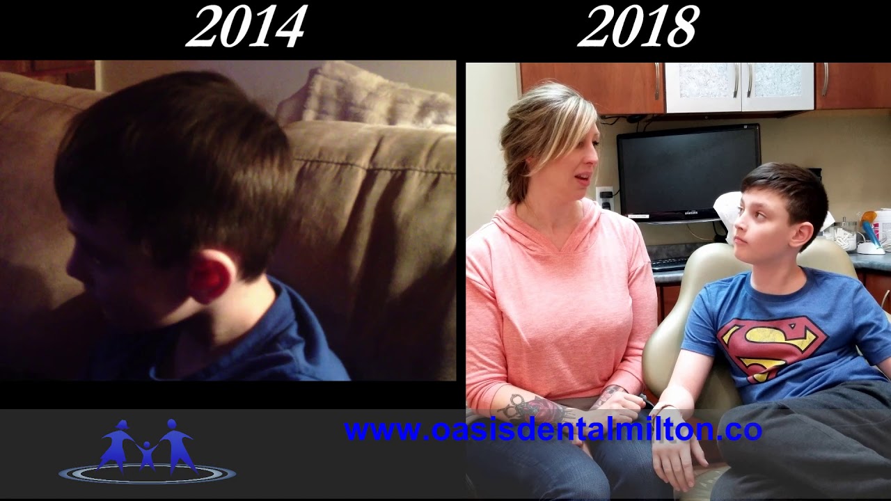 TMJ & Non Extraction Braces Treatment | Tourettes & Neck Tics Comorbidity