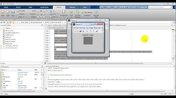 Alzheimer’s disease using matlab code