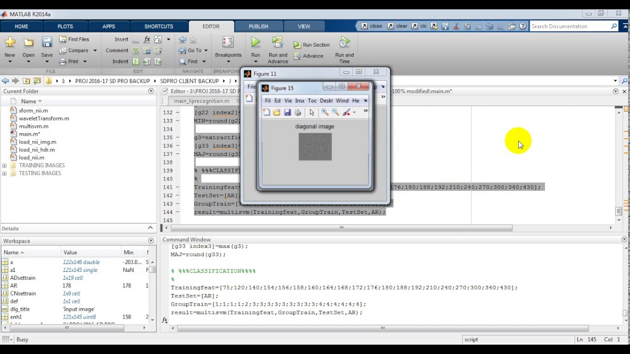 Alzheimer’s disease using matlab code - YouTube