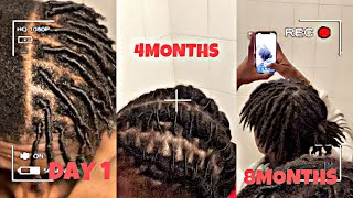 8 Months Starter Locs Dreadlocks Journey Trust The Process