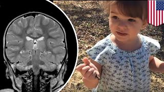 Oxygen Treatment Doctors Reverse Childs Brain Damage With Oxygen - Tomonews