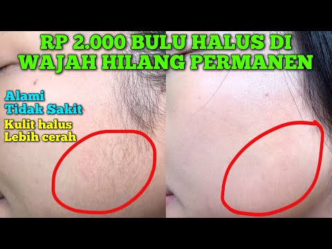 BULU HALUS DI WAJAH HILANG PERMANEN CUMA DENGAN RP 2000!! BAHAN ALAMI BIKIN KULIT HALUS DAN CERAH!