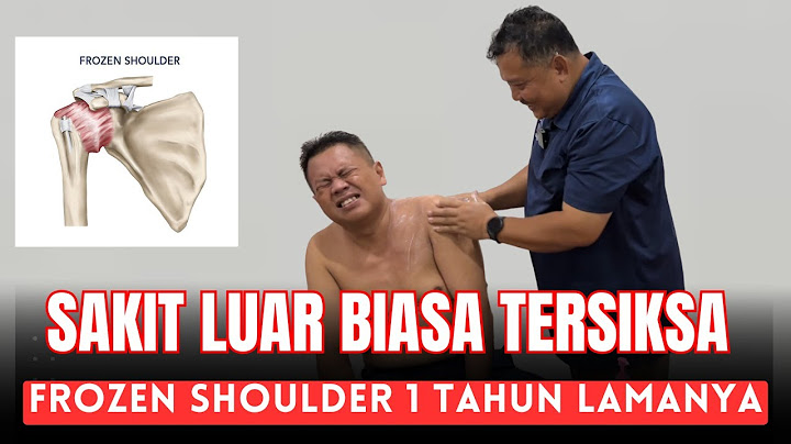 MCO ARIF - LUAR BIASA TERSIKSA FROZEN SHOULDER 1 TAHUN LAMANYA
