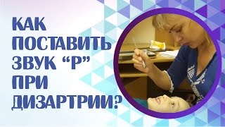 Как поставить звук "Р" при дизартрии у ребёнка с нарушением слуха? Постановка звука "Р".