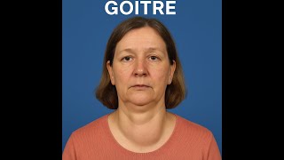 How to Differentiate Goitre (Thyroid Swelling) from a Thyroglossal Cyst: Clinical Examination