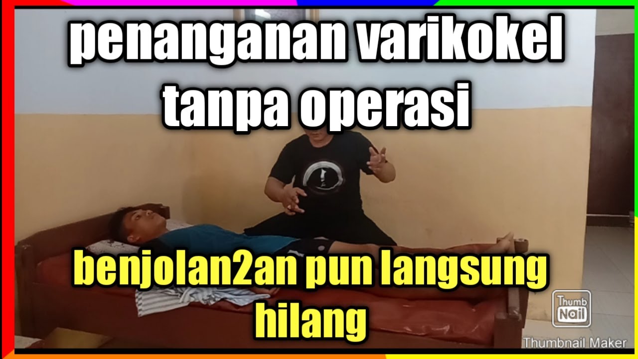 Penanganan sakit varikokel ,topcer(Blitar)