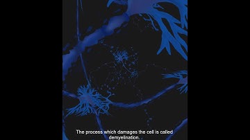 The link between MS and vitamin D deficiency