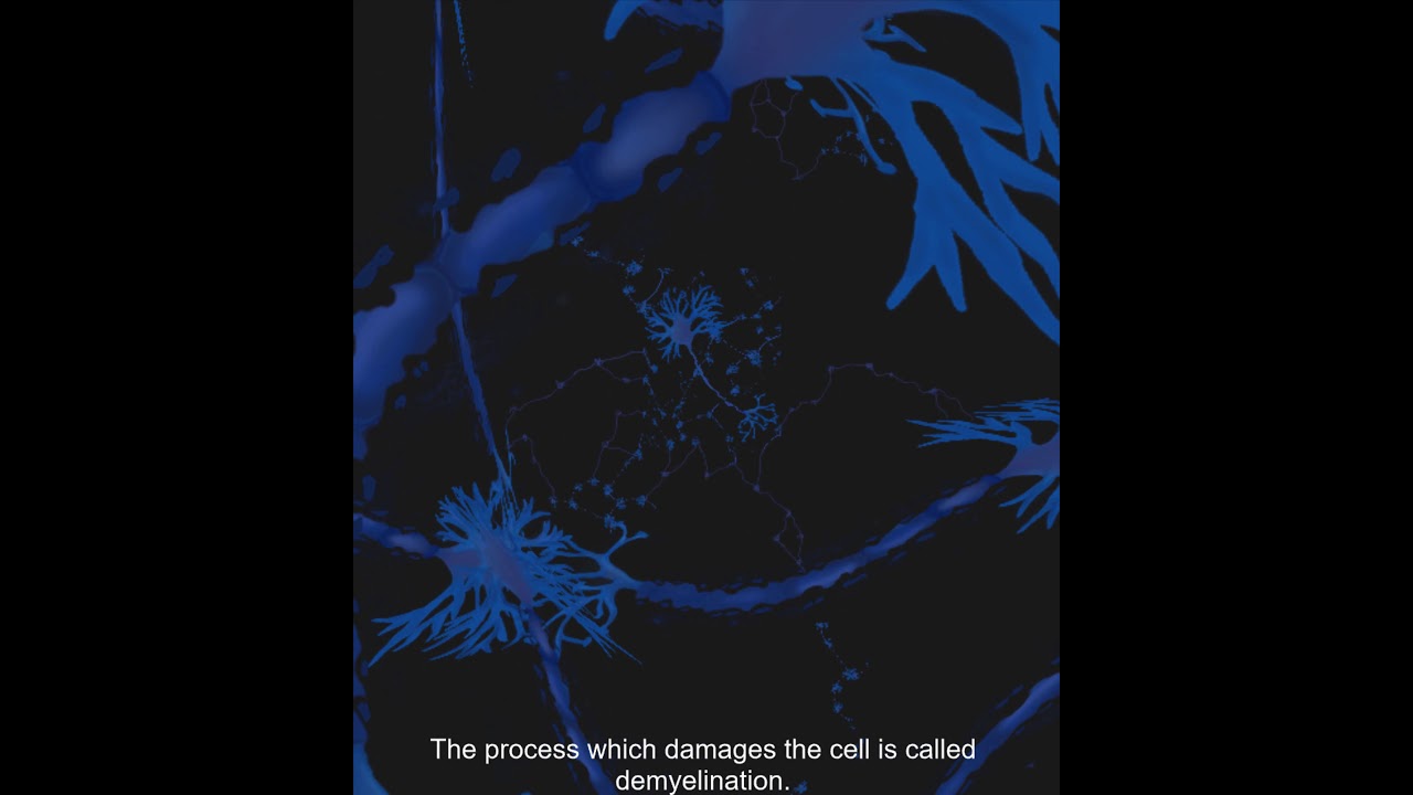 The link between MS and vitamin D deficiency YouTube