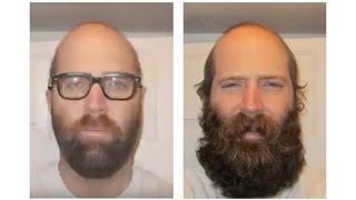 THICKEST BEARD! 6 MONTH TIMELAPSE