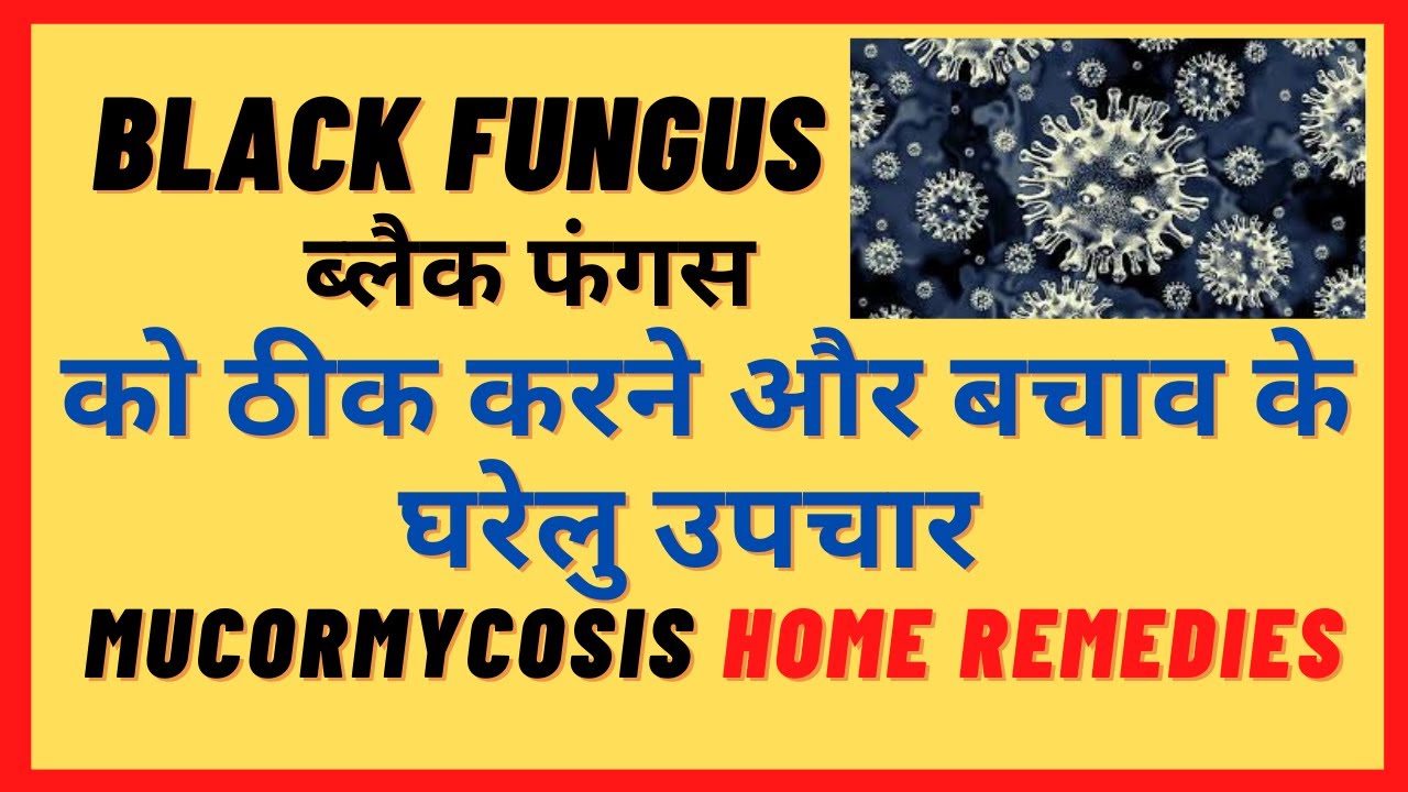 BLACK FUNGUS से बचाव के घरेलु उपचार BLACK FUNGUS HOME REMEDY