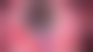 Cataract Surgery with a midsize pupil without using iris hooks or expansion devices