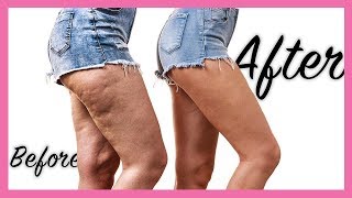 Diy Cellulite Stretch Marks Oil Smooth Legs For Summer Youtube