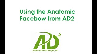 Using the Anatomic Facebow with a Patient