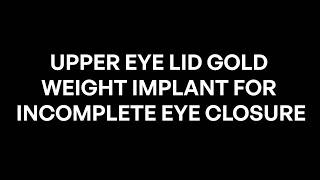 Upper eye lid gold weight implant for incomplete eye closurre #rahulbuggaveeti #amritaent