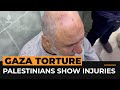 Palestinians detained in Gaza accuse Israelis of torture | Al Jazeera Newsfeed