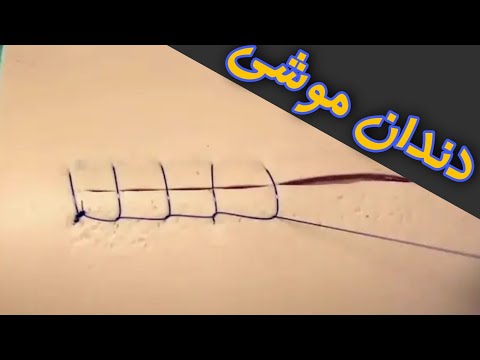 بخیه دندان موشی کانتینیوس لاکینگ