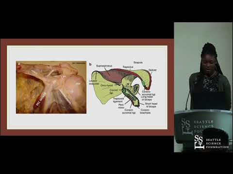 A coracoid folyamat patológiájának és veleszületett anomáliáinak áttekintése - Lexian J. McBain, MD