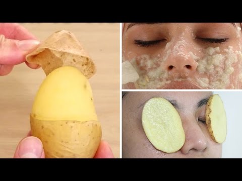 5 Surprising Uses For Potatoes