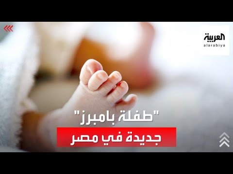 مشهد طفلة بامبرز يتكرر في مصر اغتصب طفلة بعمر  أشهر