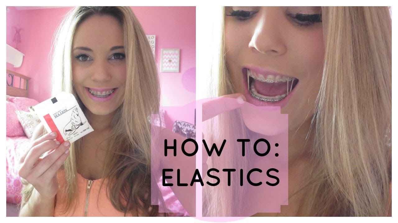How to Wear Elastics for Braces! YouTube