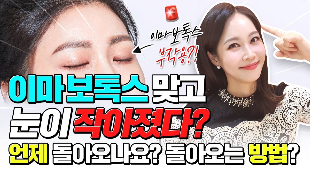 이마 보톡스 하고 눈이 작아졌다❓ '이것'만 체크하면 부작용 안생기게 이마 보톡스 가능❗ (feat.이마 보톡스 10년차 장인)