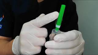 La de extracción el de después en dvt sangre brazo