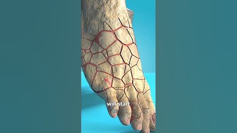 How To Grow Mushrooms On Your Feet 🤔