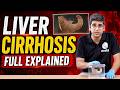 Pathology Gross Specimen: Liver Cirrhosis Explained | MBBS 2nd Year | NEET PG 2026 | PW MedEd