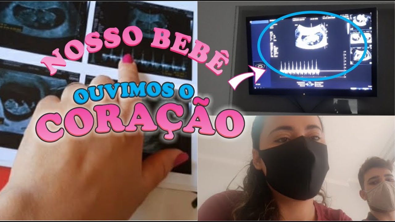 Download PRIMEIRO ULTRASSOM DO NOSSO BEBÊ!! ❤️