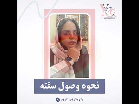 نحوه وصول سفته یوسف زاده  