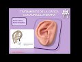 45. Tratamiento del dolor de ciática con auriculoterpia. Cursos auriculoterapia. Centro IMG