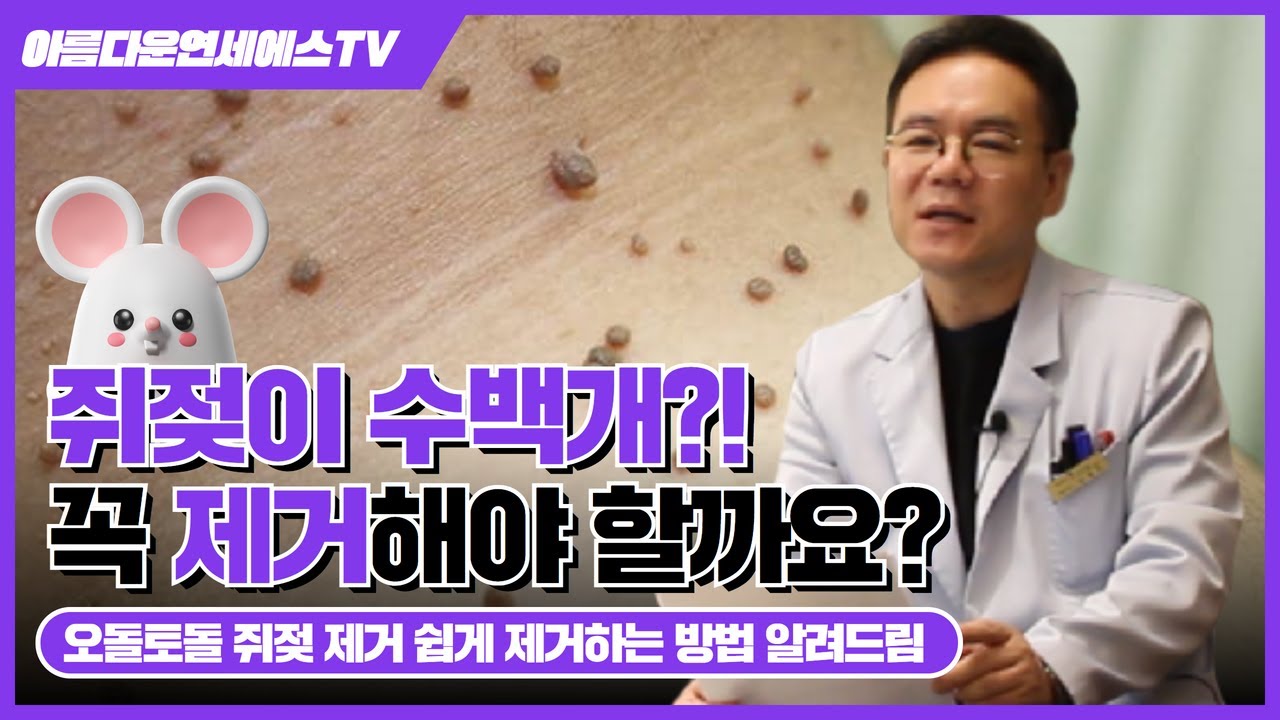 쥐젖 없애는 방법 #쥐젖없애는법, #쥐젖생기는이유, #쥐젖제거연고, #쥐젖제거크림 【대전/세종/청주/천안/공주/유성】 피부과 ...