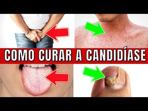 Vídeo: 4 maneiras de clarear a cor do cabelo em casa