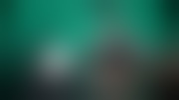 Management of calcified ledged canal with HYF EDM