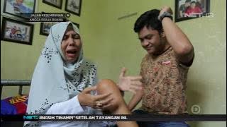 Selama 2 Tahun Alami Pengapuran Dini Hingga Kaki Tidak Bisa Digerakkan