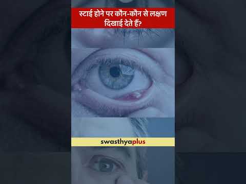 स्टाई होने पर कौन-कौन से लक्षण दिखाई देते हैं? | Symptoms of Stye | Prof Dr Vijay Pratap Singh Tomar