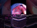 LUCY BEDROQUE + PRETTIFUN TYPE BEAT "NOLOVE2DAY"
