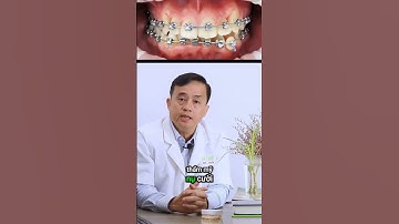 Mất răng 6 nên niềng răng hay cắm implant    #implant  #dnmedia #chiasekinhnghiemtrongimplant